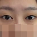 유노성형외과의원 네이버블로그