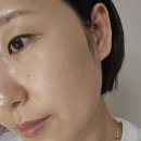 두부에스테틱