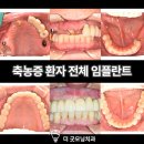 강도욱치과의원 네이버블로그
