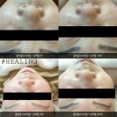 샾피부하다