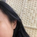 선 피부앤바디 이미지