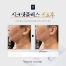 씨크릿플러스