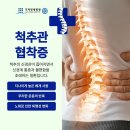 일산역신경외과 허리가 아파 오래 걷지 못하는 원인은? 이미지