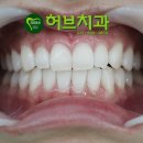 허브치과 이미지