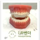 연세라벤더치과교정과치과의원 네이버블로그