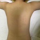 황금뷰티 | ⭐️ 서인애 뷰티샵 황금 드레스라인 케어 받고 온 리얼 후기