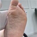 지산역 | 대구 지산역 발각질 거칠어진 발관리 잘하는 곳 네일바이엘