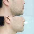 털보헤어플러스의원 | 전기면도기 추천, 면도기 사용 후기 브라운 시리즈 9 프로 플러스 울트라 씬