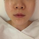 핌케어 | 루원시티 피부관리 핌에스테틱 인천 웨딩케어 솔직후기