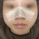 벨르스킨 | 우만동 피부관리샵 라라벨르 스킨플래닝 후기