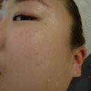 동방빌딩별관(관리실) | 남포동 에스테틱 분위기 좋은 스마일피부탈모센터 기본피부관리 수딩소스 후기