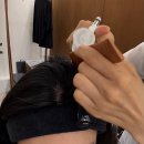 별내약국 | 남양주 별내 두피탈모관리 두앤피 본점 AI 두피케어 후 문제성 두피관리 받은 후기