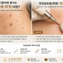 고운빛의원 티스토리