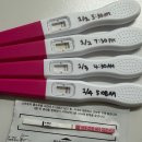 서울아이앤여성의원 | [임신준비#2] 나팔관조영술 후기 | 서울아이앤여성의원 검사 과정, 비용, 통증 기록