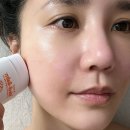 손톱소지 - 창원시 성산구 | 위메디밤 활용법, 피부 가려움 잡는 순한 멀티밤 피부보습제 후기