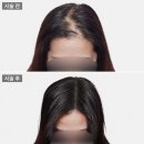 금난의집 | 서울 성동구 두피문신(SMP), 상담 전 꼭 확인해야 할 5가지