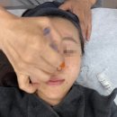 타이팅 메디케어 스킨앤바디 | 홍대리프팅잘하는곳 타이팅 메디케어 스킨앤바디 솔직후기