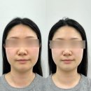 손수에스테틱 | 안동 피부관리 추천 손수에스테틱 윤곽관리 후기