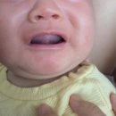 김민희의원 | 2개월아기 수원 설소대수술 후기, 현대해상 청구 방법