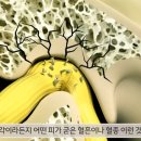 마비