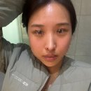 쁘띠멍멍 | [홍대] 귀필러 내돈내산 후기