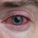 경산제일안과 이미지