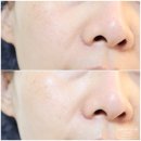보다주팩토리 | 투명피부 더마팩토리 잡티 지우개 트라넥삼산 크림 7일째 과연 맑아졌을까