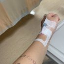 253110 | 신촌 세브란스 권자영 교수님 맥도날드 수술 후기