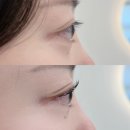 중앙학문병원 | 울산 달동속눈썹펌 가성ㅂㅣ 좋은 곳 라무르브로우