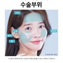 스노우의원 이미지