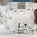 횡성치과의원 이미지