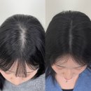 수원-1951 | [용인 두피커버 추천] '닷센스 SMP 용인광교점' 두피커버 찐 만족 후기 👍