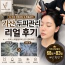 T-솔루션센터 | [금천/가산] 가산 두피관리 추천! AI 두피진단부터 맞춤관리까지 비채두피탈모센터 후기