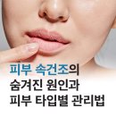 톡스앤필의원원주점