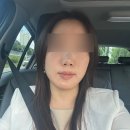 라임스킨 | 선정릉역피부과 쥬브아셀V 6CC 캐뉼라공법, ECM 스킨부스터 후기
