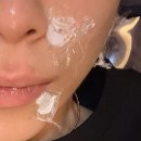 샘깊은약국 | 26. 03. 26. 일상 / 대전 점 제거 내돈내산 후기 (홍보일시 뛰어내림)