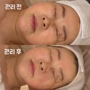 딜리스미에스테틱 | 당진피부관리, 염증과 트러블, 피부재생, 탄력 리프팅과 보습, 붓기, 멜라소닉♥ 딜리스미에스테틱
