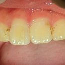 감일퍼스트치과의원 이미지