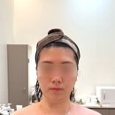 231 | 다산 피부관리실 미올뷰티 신부관리 올모드 윤곽 관리 추천 후기