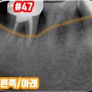 소실화원