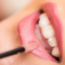 노블치과교정과치과의원 이미지