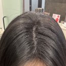 원스칼프 | 여자정수리탈모 두피관리 커버 원스칼프 부산본점 후기