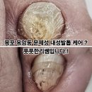 옥암로 96번길 15 | 목포 옥암동 문제성 내성발톱 케어 전문 풋풋한리쌤입니다.