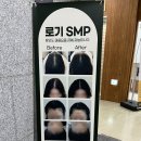 로기SMP