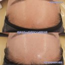 광교피부관리 엘트리움스킨앤바디 수원광교점 G-웨이브 맞춤윤곽관리 솔직 후기
