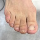 문제성 손, 발 오감네일 이미지