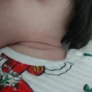 본메디조아의원 네이버블로그
