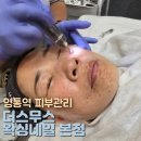 영통역 피부관리 더스무스 왁싱네일 본점 THE SMOOTH 플라즈마 후기