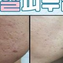 미엘에스테틱