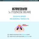 닥터미성형외과의원 | 닥터미성형외과의원에서 무보형물코수술을 하는 노즈빔을 소개합니다